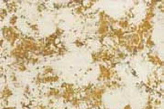 Antikspiegel cometa,